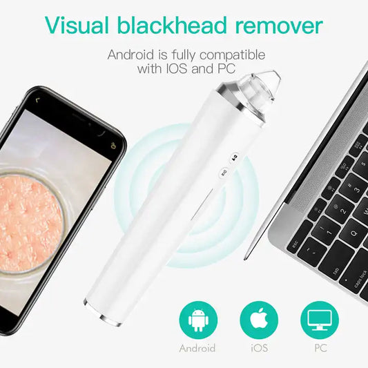 blackhead-remover-with-app-camera-portable-and-rechargeable