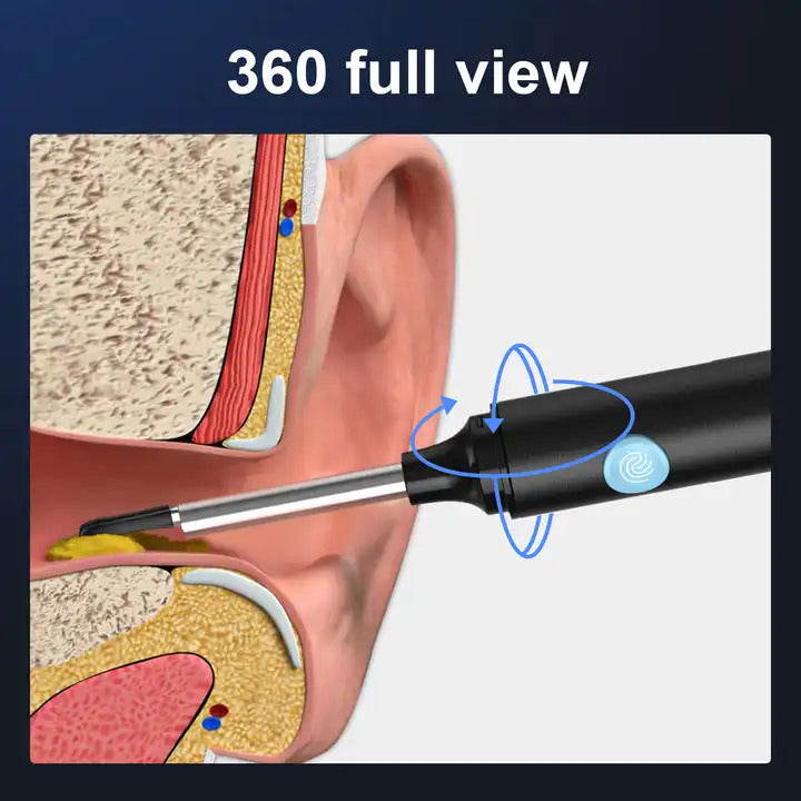 Ear cleaner with app camera features a high-resolution camera